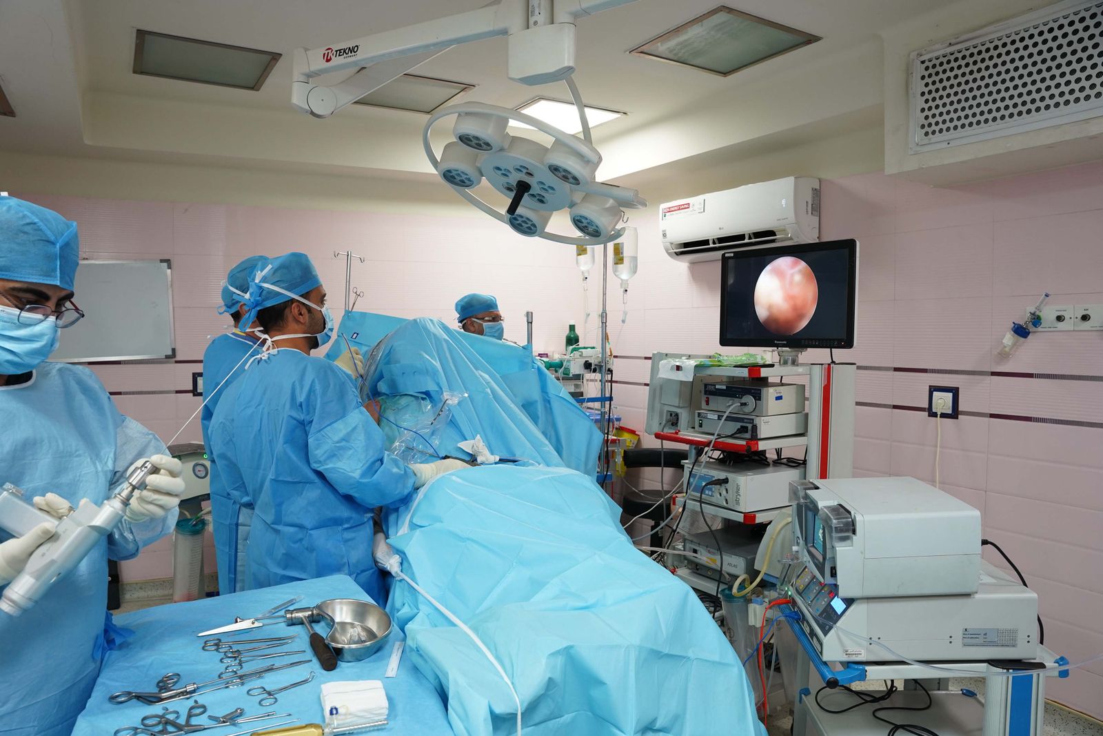 Laparoscopic Procedures